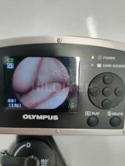Olympus MAF-TM Bronchoscope - 9