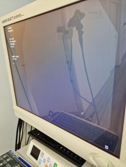 Olympus CF-H190I Colonoscope - 5