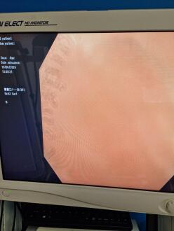 Olympus CF-H190I Colonoscope - 7