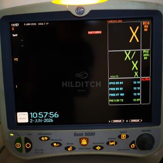 GE Dash 5000 Compact Multiparameter Monitor - 2