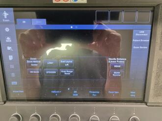 Toshiba Aplio i800 Ultrasound - 5