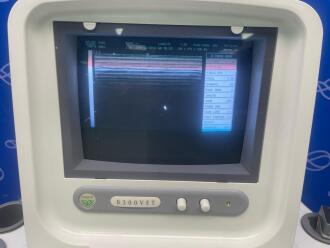 Chison 8300VET Veterinary Portable Ultrasound on Trolley - 2