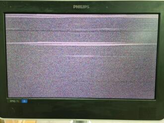 Philips Epiq 7G Ultrasound - 6