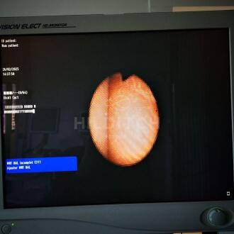 Olympus ENF-P3 Nasofibroscope - 4