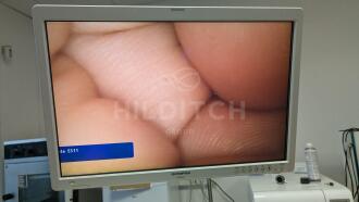 Olympus OEV261H Screen - 2