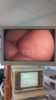 Fimi MED24ESH Video Screen - 2