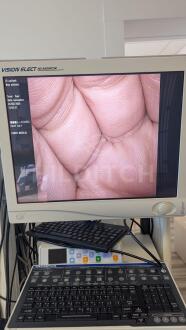 Olympus A50000A laparoscope - 3