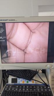 Olympus A50000A laparoscope - 4