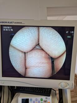 Fujifilm EC-530Wi3 Colonoscope - 7