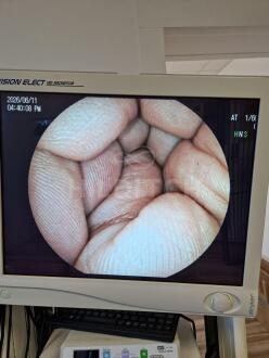 Fujifilm EC-530Wi3 Colonoscope - 8