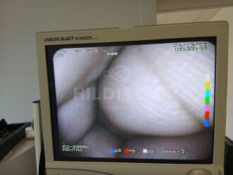 Pentax EPK-700 Video Processor - 6