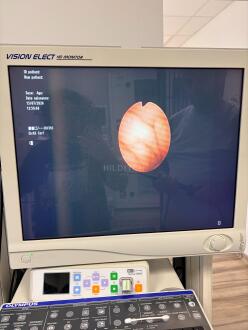 Olympus LF-2 Fibroscope - 8