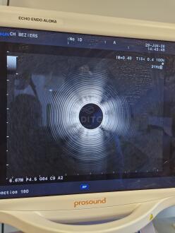 Olympus GF-UE160-AL5 Echoendoscope - 9
