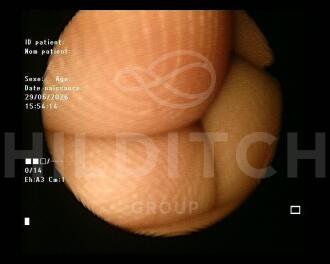 Fujifilm FG-1Z Fibrogastroscope - 2