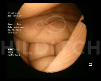Fujifilm FG-1Z Fibrogastroscope - 3