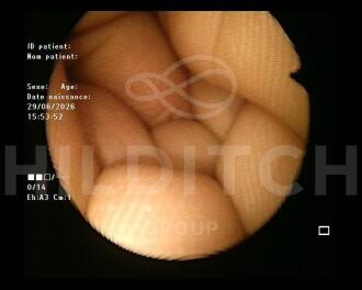 Fujifilm FG-1Z Fibrogastroscope - 4