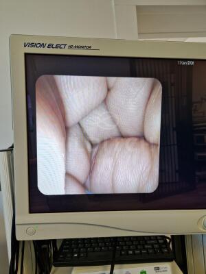 Pentax EG-3870UTK Echo Endoscope