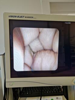 Pentax EG-3870UTK Echo Endoscope