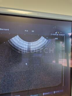 Pentax EG-3870UTK Echo Endoscope - 5