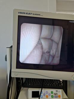Pentax EG-3870UTK Echo Endoscope - 7