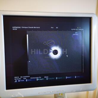 Pentax EG-3670-URK Echo Endoscope - 5