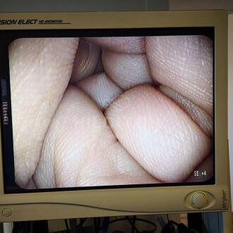Pentax EG-3670-URK Echo Endoscope - 6