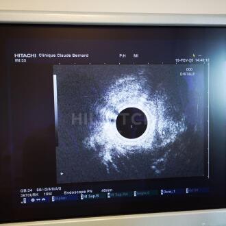 Pentax EG-3670-URK Echo Endoscope - 7