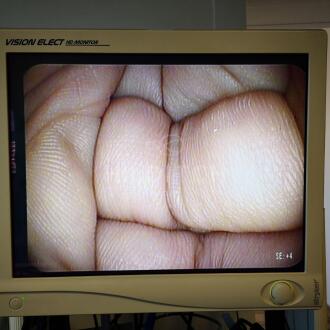 Pentax EG-3670-URK Echo Endoscope - 8