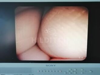 Pentax EG-3670-URK Echo Endoscope - 11