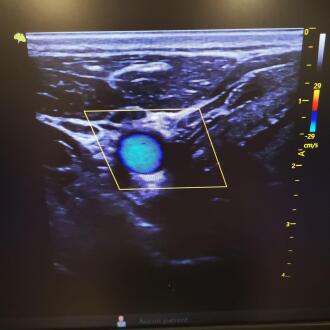 Vinno E20 Ultrasound - 5