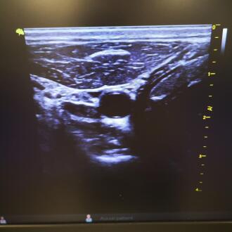 Vinno E20 Ultrasound - 8