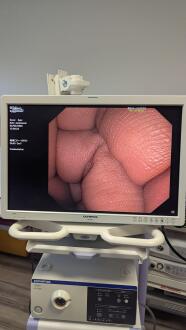 Olympus WM-NP1 +OEV261H + CLV-S190 + OTV-S190 + MAJ-1084 Endoscopy Column - 3