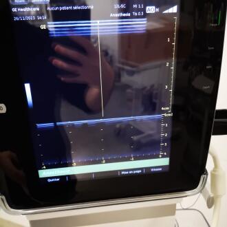 GE Venue 40 Ultrasound - 4