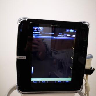 GE Venue 40 Ultrasound - 9