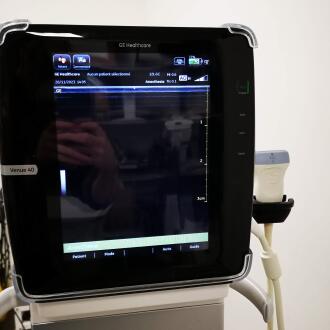 GE Venue 40 Ultrasound - 12