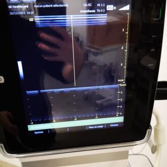 GE Venue 40 Ultrasound - 14