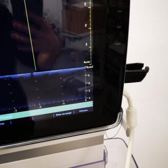 GE Venue 40 Ultrasound - 16