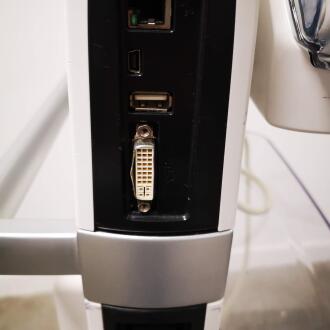 GE Venue 40 Ultrasound - 17
