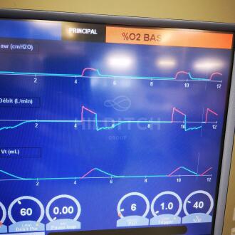 Carefusion Avea Ventilator - 7