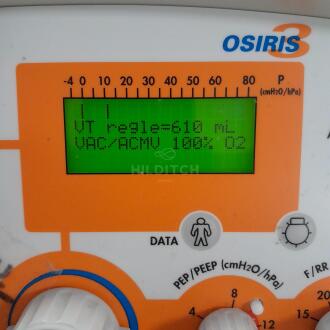 Taema Osiris 3 Ventilator - 5