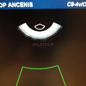 Philips C8-4V Endocavitary Transducer - 5
