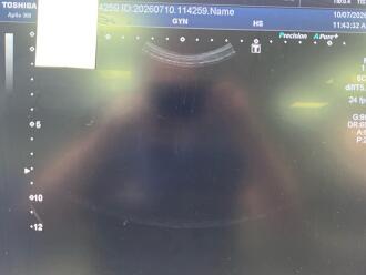 Toshiba Aplio 300 Ultrasound - 8