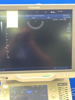 Toshiba Aplio 300 Ultrasound - 10