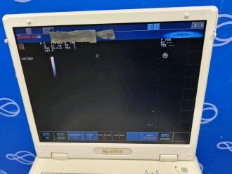Esaote My Lab 25 Gold Portable Ultrasound on Trolley - No HDD - 4