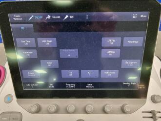 Siemens Acuson S1000 Ultrasound - 5
