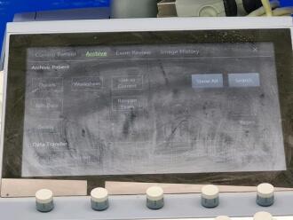 GE Voluson E8 BT16 Ultrasound - 2