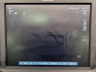 Sonosite Edge Portable Ultrasound on Sonosite Edge Trolley - 5