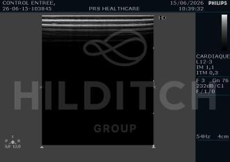 Philips EnVisor C HD Ultrasound - 5