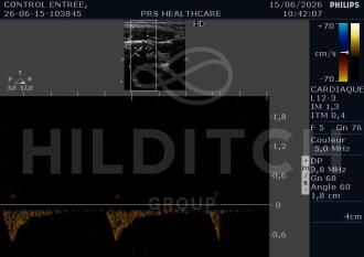 Philips EnVisor C HD Ultrasound - 6