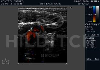 Philips EnVisor C HD Ultrasound - 7